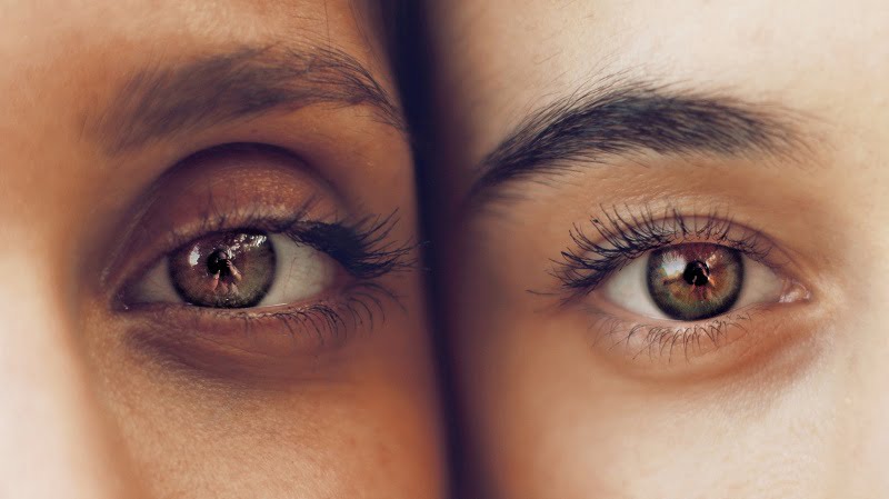Eyelid Plastic Surgery Chicago Morton Grove