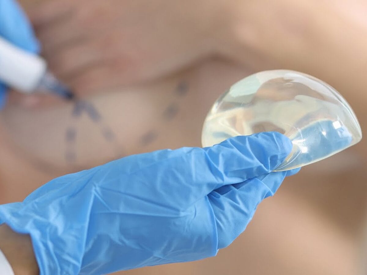 Breast Implant Chicago Suburbs