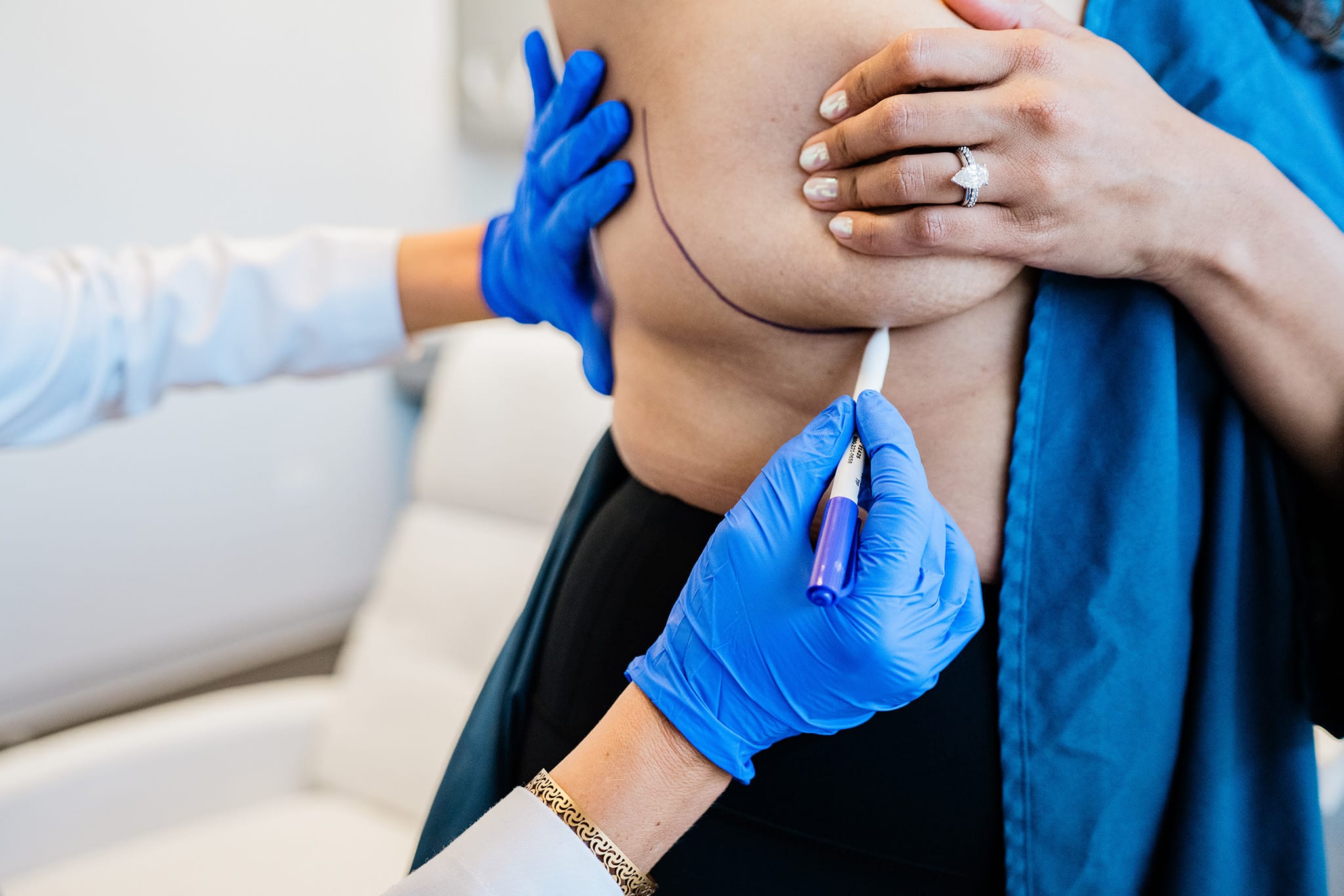 Breast Lift Chicago Suburbs 2