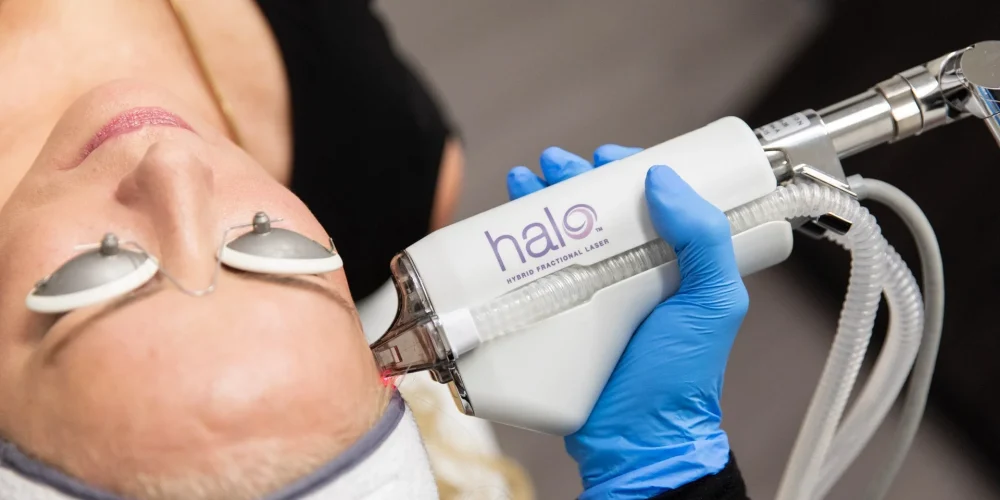 Halo Laser Treatment Chicago plastic sugery