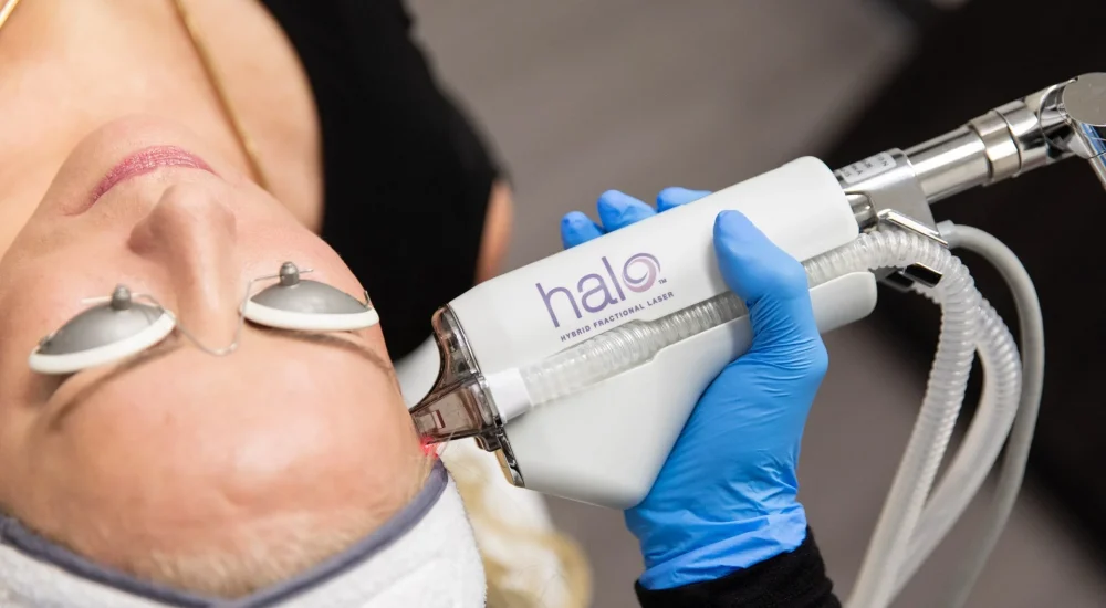 Halo Laser Treatment Chicago plastic sugery