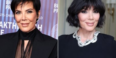 Kris Jenner, Facelifts