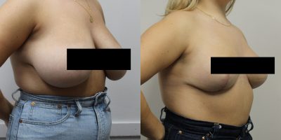 Sara plastic surgery morton grove