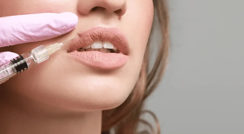 lip filler chicago
