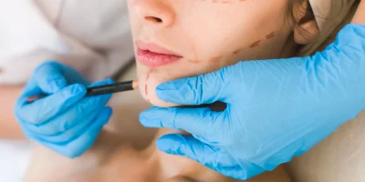 plastic surgery morton grove